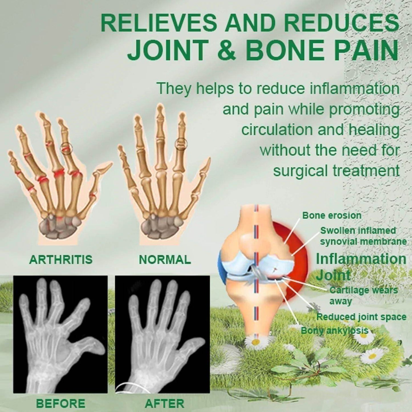 Bee Venom Joint and Bone Therapy Cream (Pack of 3) - online shope